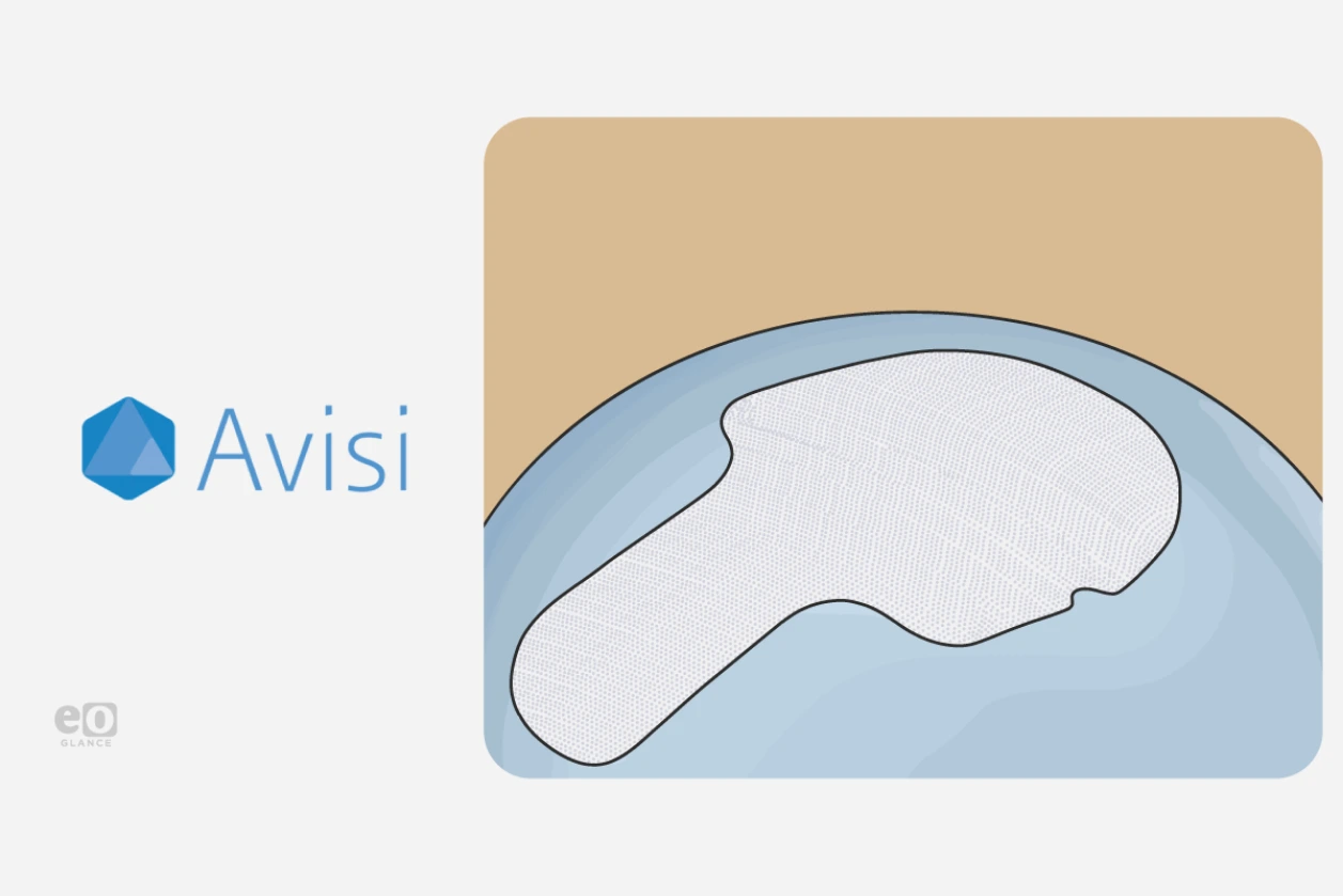 Avisi raises $10.7M to advance study on VisiPlate glaucoma device